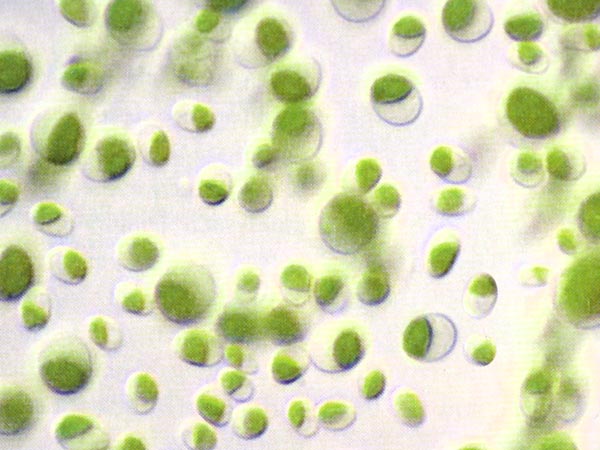 Chlorella Algen unter dem Mikroskop